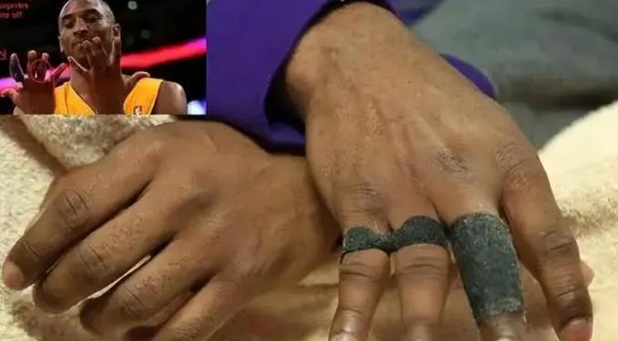 看了科比手指，詹姆斯脚趾，你就相信 NBA球星是透支身体赚钱(2)