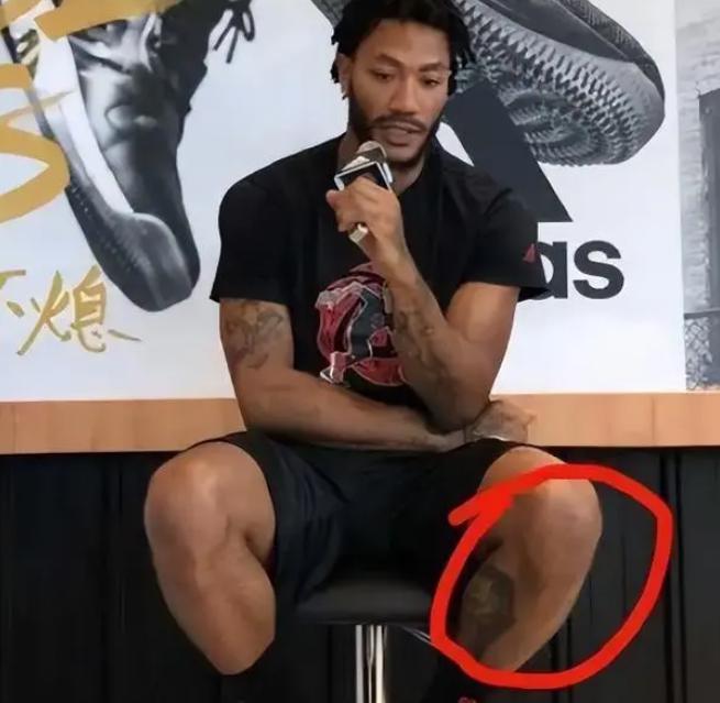 看了科比手指，詹姆斯脚趾，你就相信 NBA球星是透支身体赚钱(5)